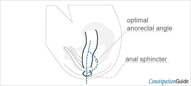 The anatomical illustration shows the correct body position for optimal anorectal angle.