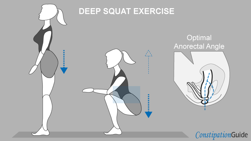A person is performing deep squat hip stretches with guidance, highlighting the result of increasing the anorectal angle to aid stool evacuation.