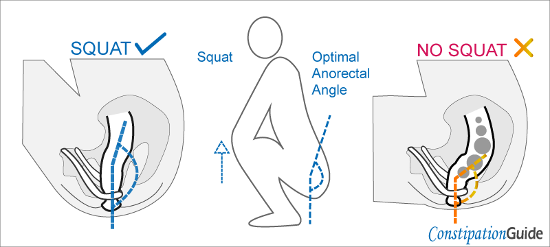 An illustration depicts a person in a squatting posture, demonstrating the dynamics of increasing and decreasing the anorectal angle anatomy.