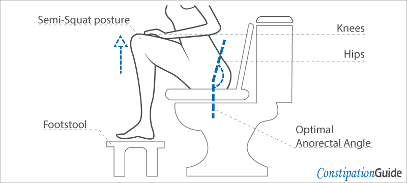 The image depicts a person sitting on a toilet bowl in a semi-squat posture, with a footstool positioned beneath their feet.