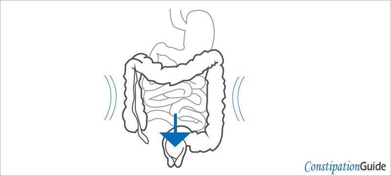 straining and pushing the rectum to evacuate the stool image